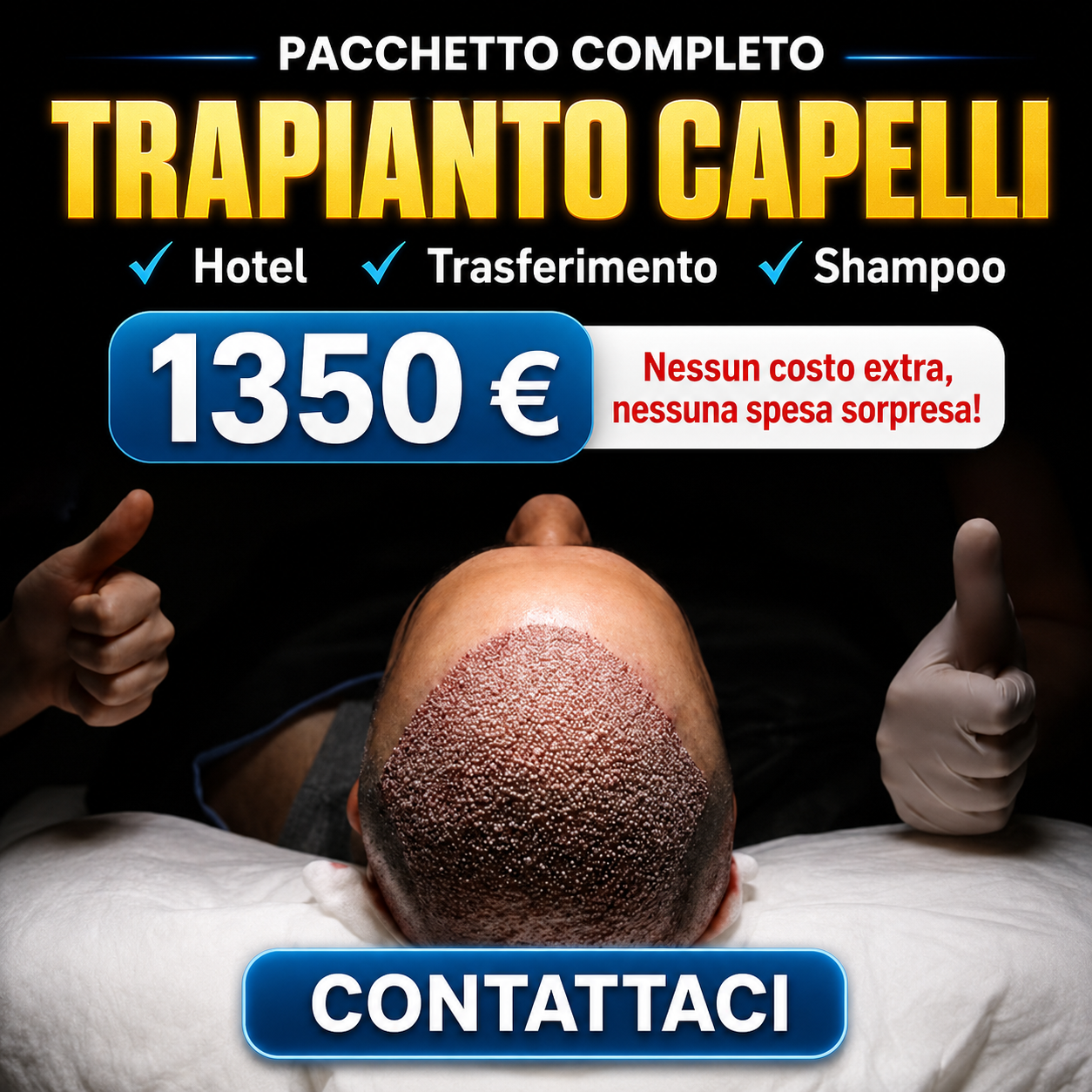 Trasplante capilar en Tirana